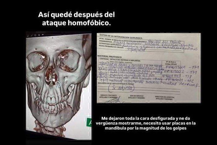 Brutal golpiza a un joven gay en Palermo 